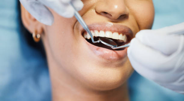 Best Emergency Dental Care for Broken or Chipped Teeth in Collinsvle, IL